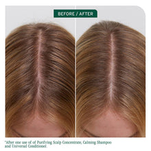 Load image into Gallery viewer, Biolage Scalp Sync Purifying Scalp Concentrate