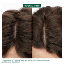 Load image into Gallery viewer, Biolage Scalp Sync Anti-Dandruff Shampoo