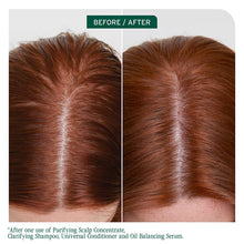 Load image into Gallery viewer, Biolage Scalp Sync Oil Balancing Serum