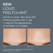 Load image into Gallery viewer, Dermalogica Liquid Peelfoliant