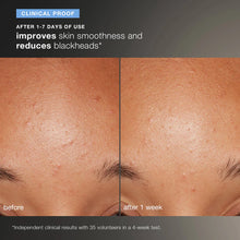 Load image into Gallery viewer, Dermalogica Daily Microfoliant Exfoliator