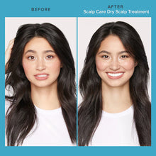 Load image into Gallery viewer, Living Proof Scalp Care Dry Scalp Treatment