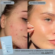 Load image into Gallery viewer, Imarais Beauty Clarity Skincare Supplement
