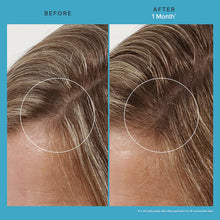 Load image into Gallery viewer, Scalp Care Revitalizing Treatment

